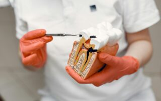 Debunking Common Root Canal Myths and Facts